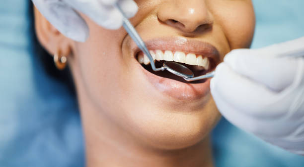 Best Emergency Wisdom Teeth Removal in Roessleville, NY