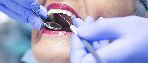 Best Emergency Treatment for Toothache in Roessleville, NY